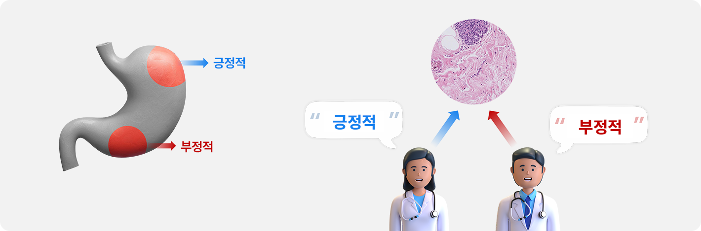 PD-L1 해석 다이어그램